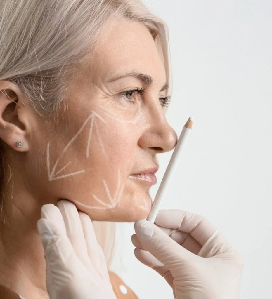 Facelift in Turkey Antalya