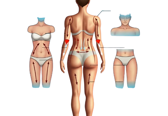 Liposuction in Turkey, Antalya