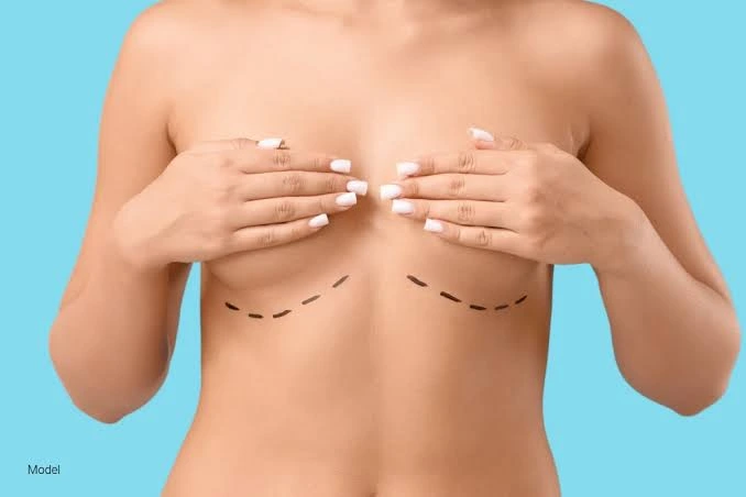 Breast augmentation in Turkey, Antalya