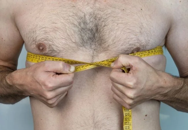 Gynecomastia in Turkey, Antalya